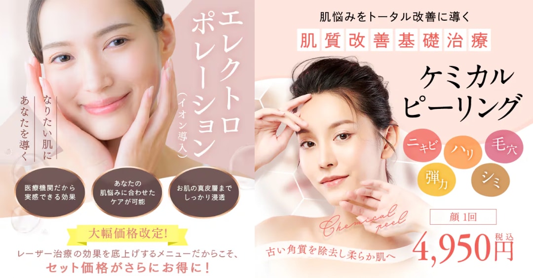エレクトロポレーション＋ケミカルピーリング