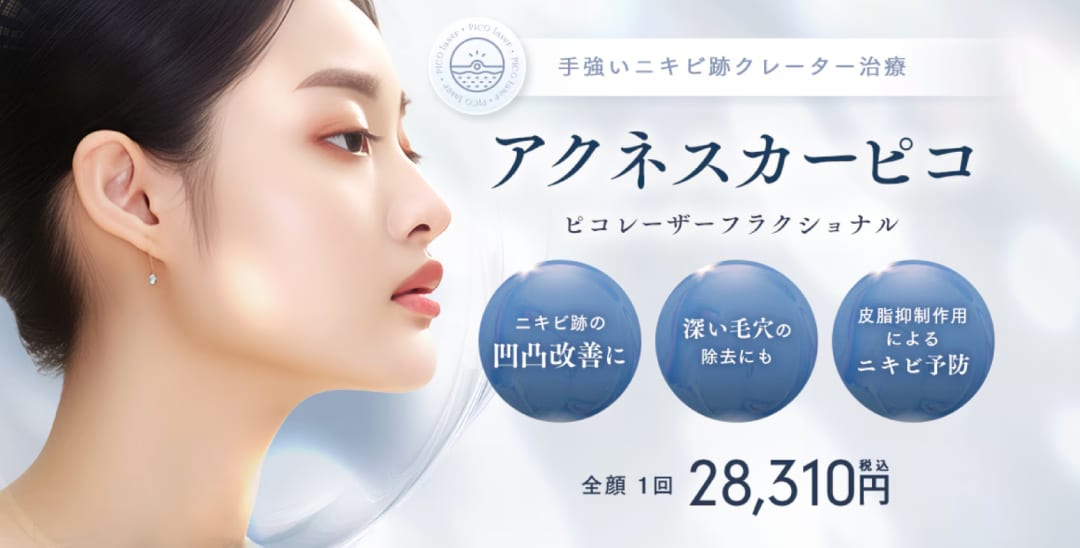 アクネスカーピコ