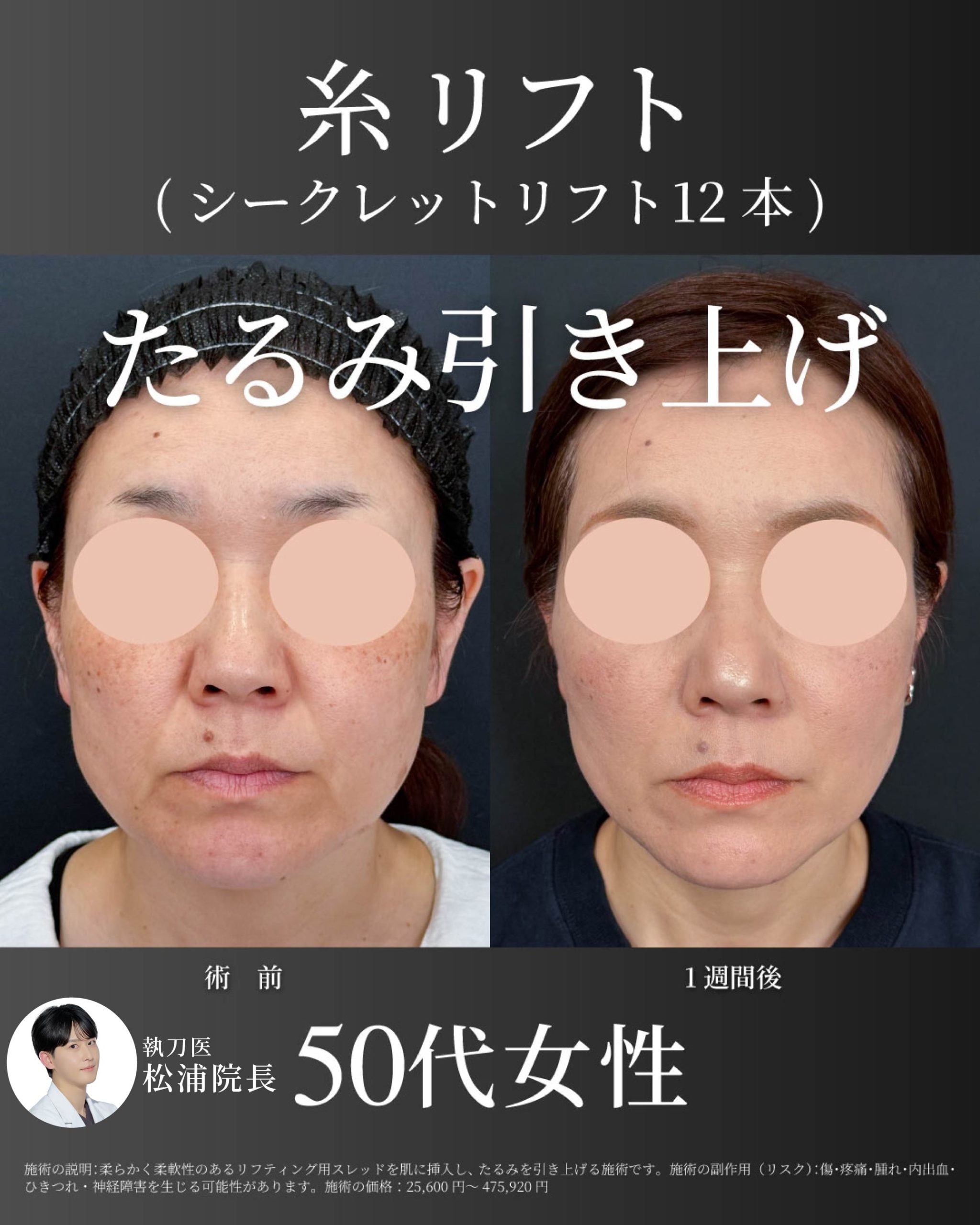 松浦院長症例