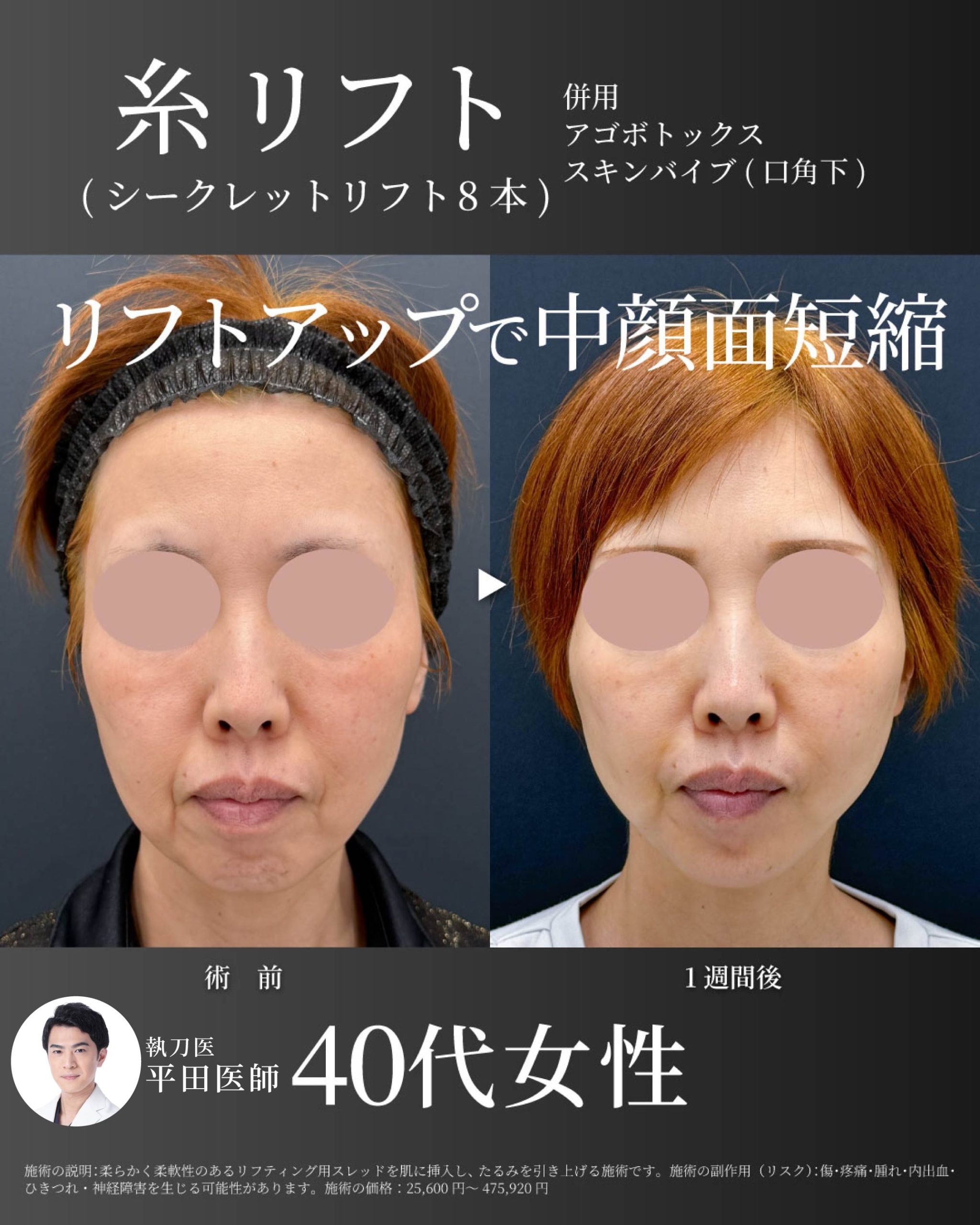 平田医師症例