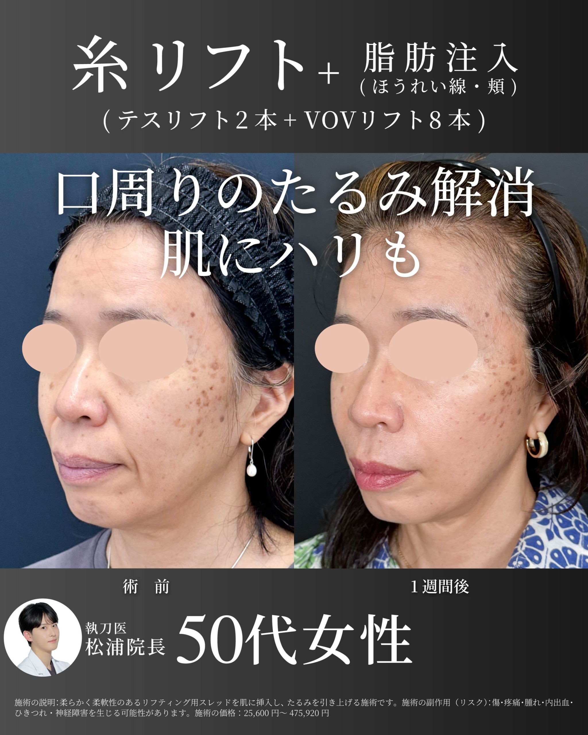松浦院長症例