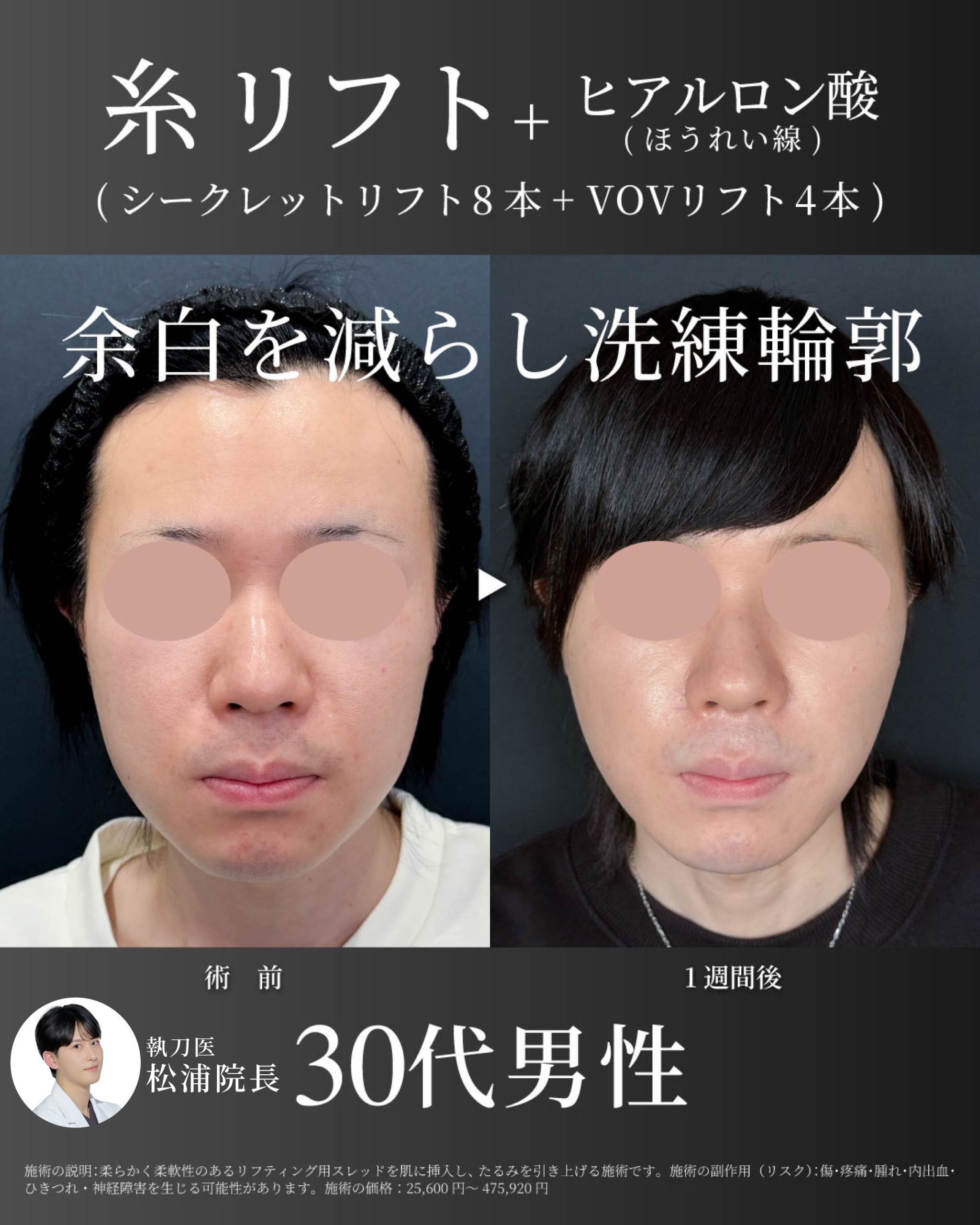 松浦院長症例