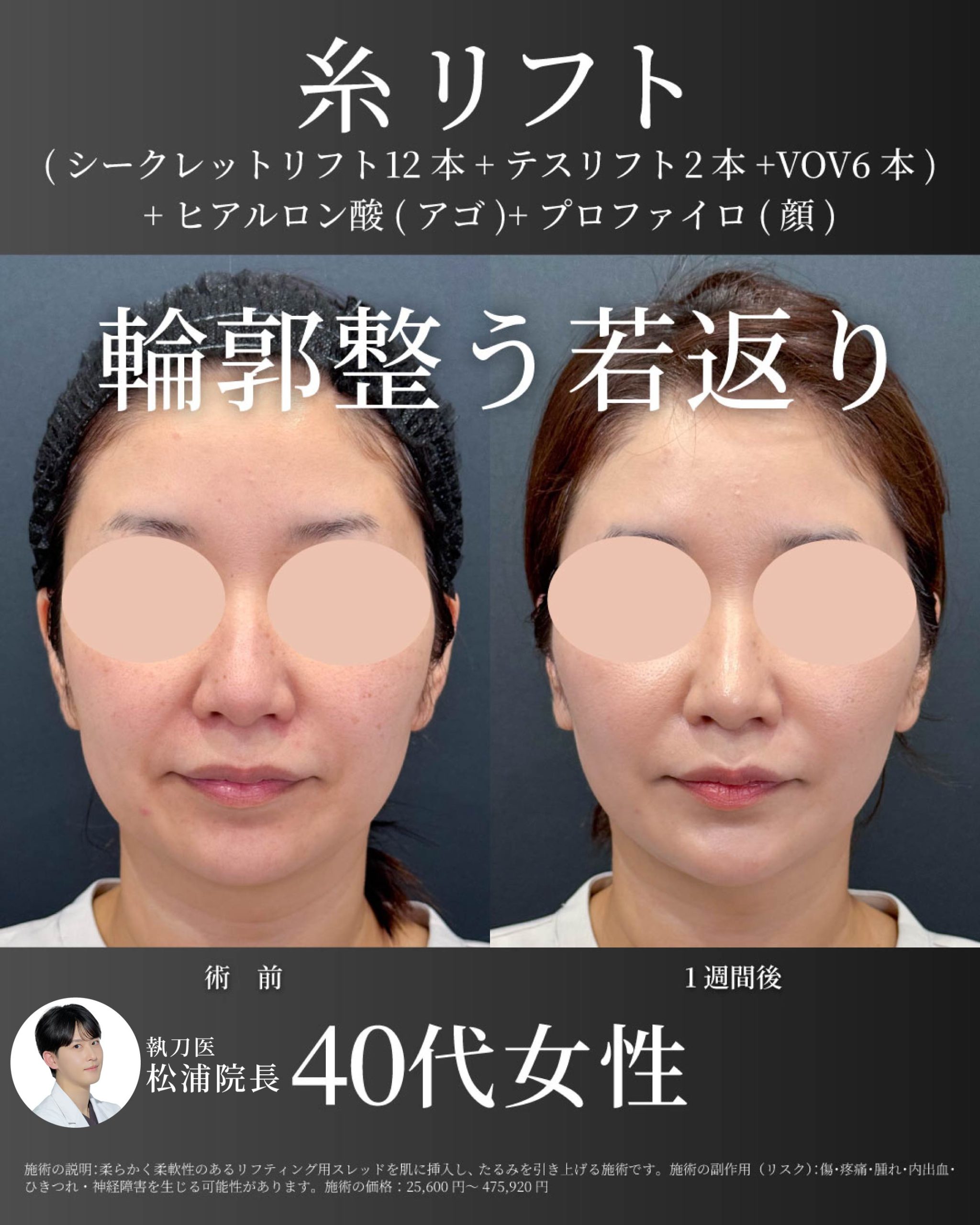 松浦院長症例