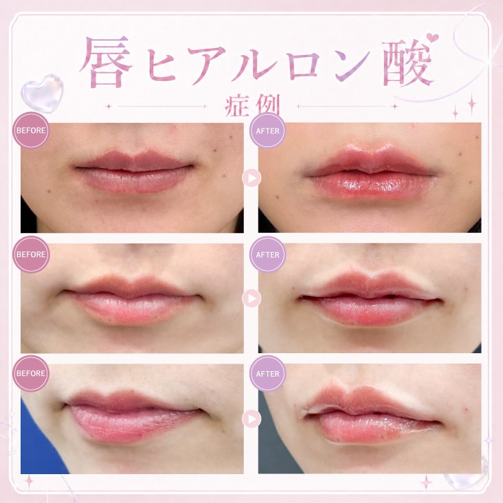 唇の症例