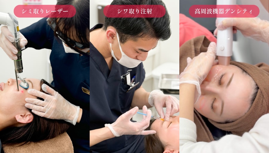 【シミケア＆予防】シミ取りレーザー