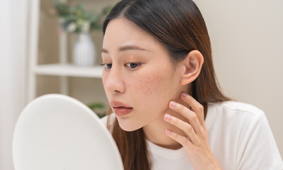 そばかすや頬の赤みが、メイクで隠しきれない方へ