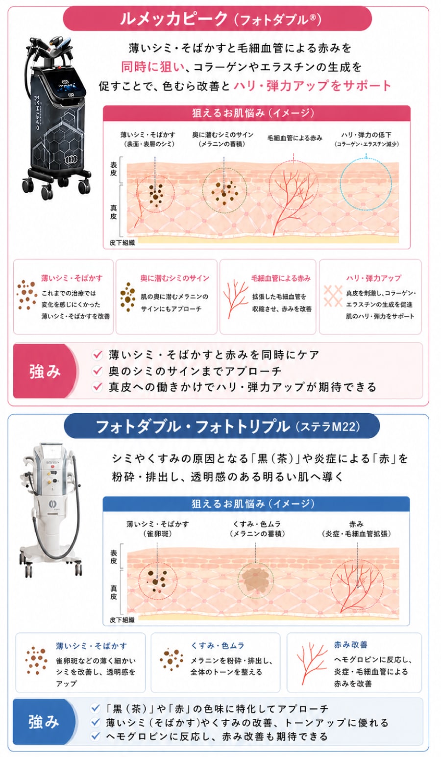 高崎院のフォトダブル・フォトトリプル（ステラM22）との違い