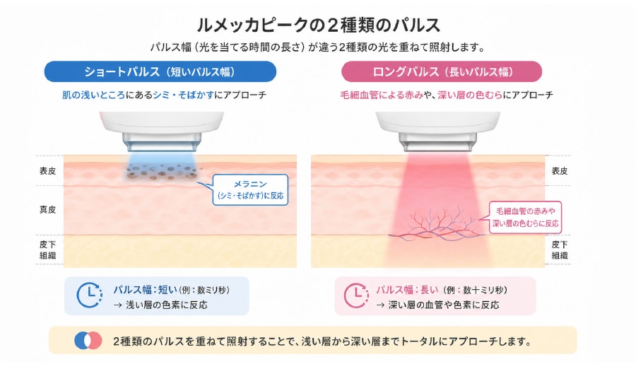 シミと赤みを1回の施術でケアできる