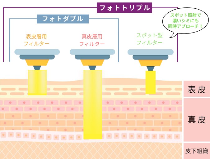 アプローチする段階が違う!