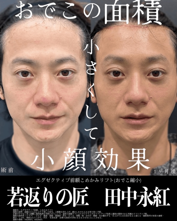手術の結果は…？