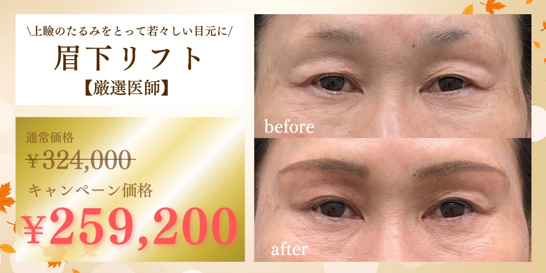 まぶたのたるみ改善・目ヂカラUP🌟