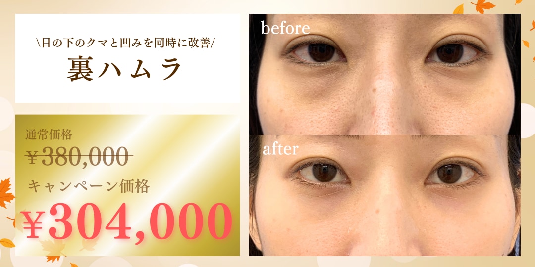 目の下のクマを解消し若々しく明るい目元に☀️