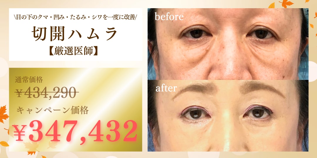 目の下のクマ・たるみを根本から改善🌟