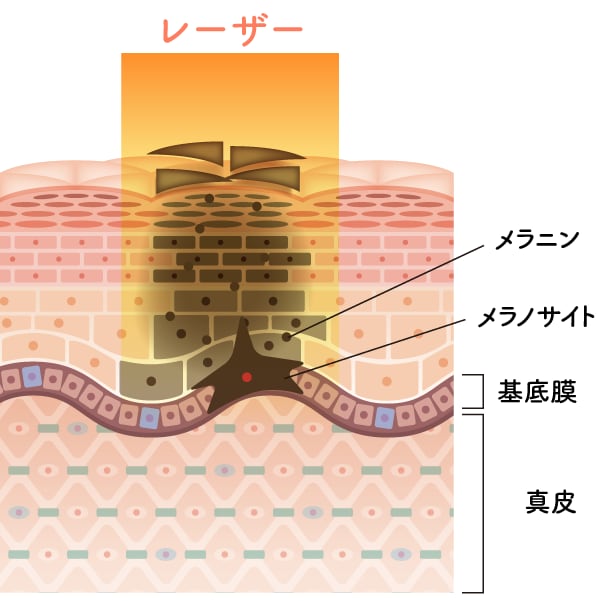 《シミが取れる仕組み》