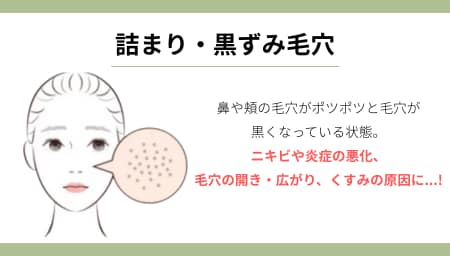 タイプ①：いちご鼻になりやすい「詰まり・黒ずみ毛穴」