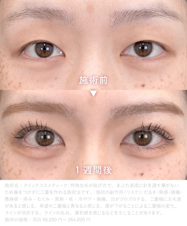 クイックコスメティーク・ダブルNEO