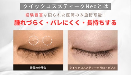 腫れにくく、バレにくい埋没二重の最高峰