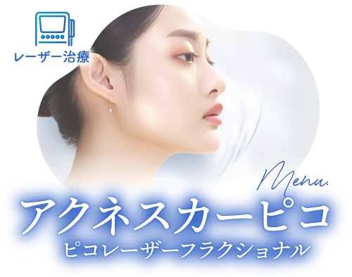 毛穴・ニキビ跡の凹凸にお悩みなら<br />
「アクネスカーピコ」