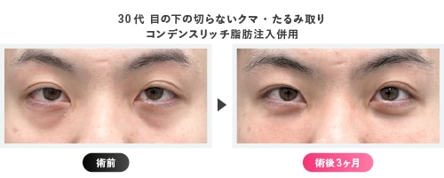 男性にも選ばれています<br />
「お疲れ顔」を解消して若々しい印象へ