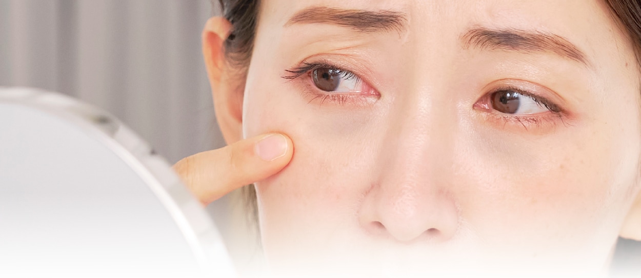 クマ改善を外科手術以外で