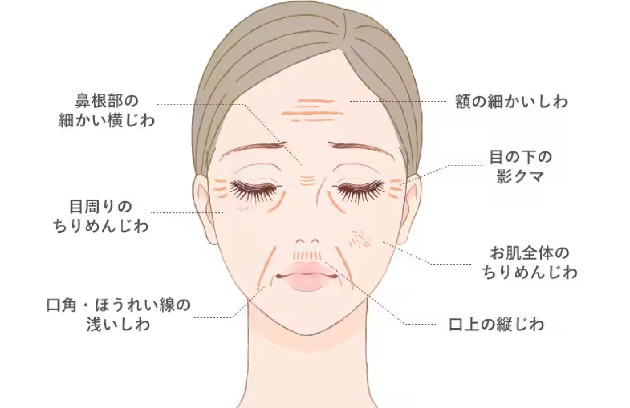 注入できる部位とその効果