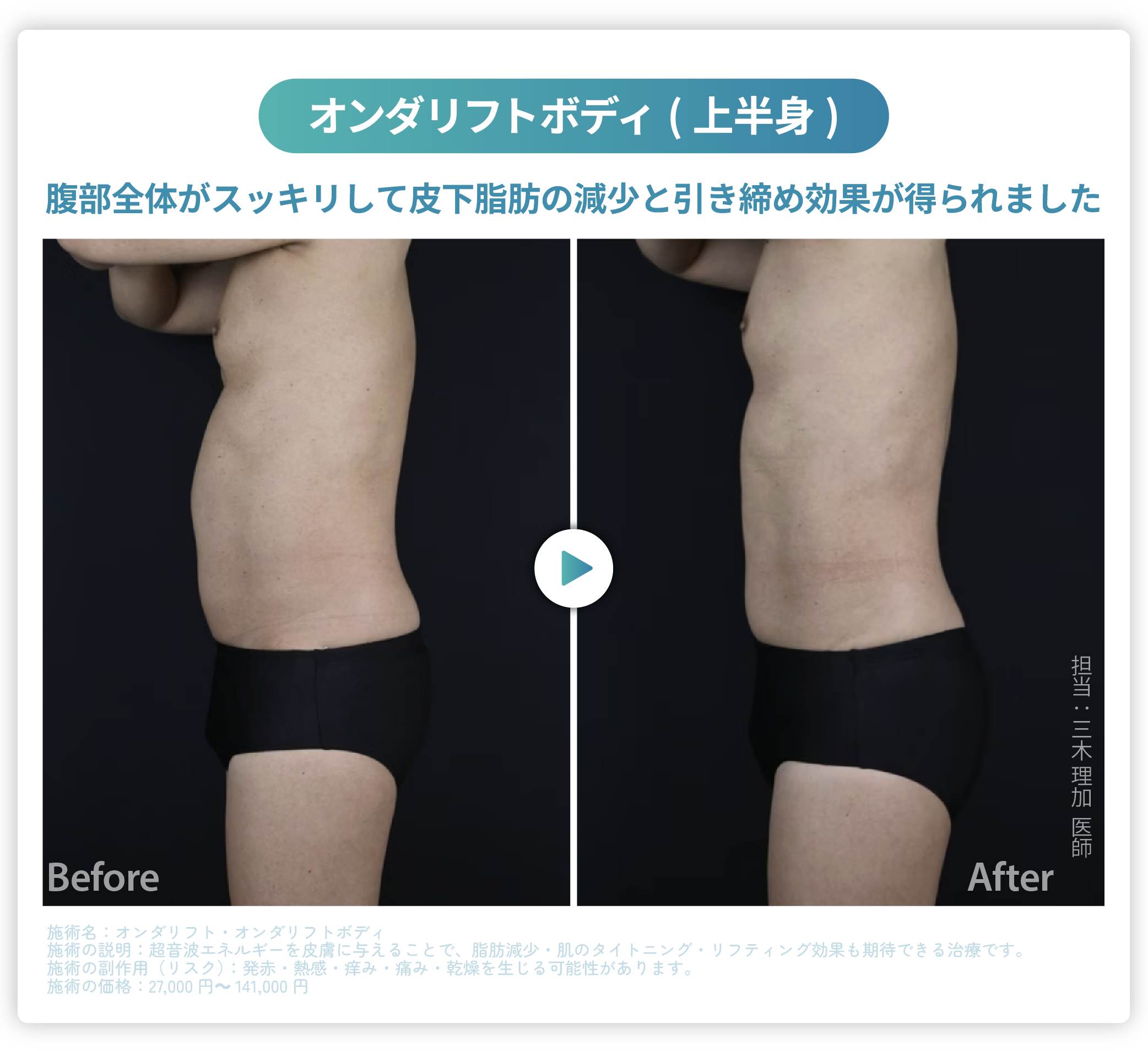 大阪・高槻】オンダリフトが遂にSBC高槻院に登場！韓国で人気の痩身