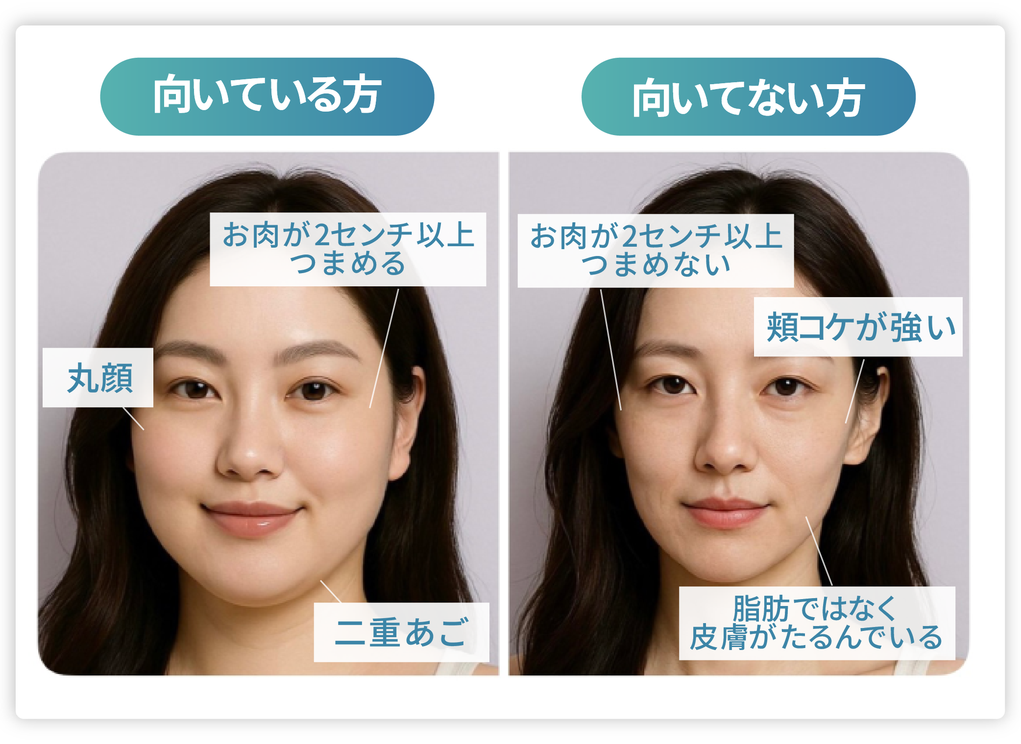 オンダリフトはどんな人に向いてる？