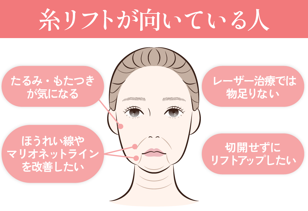 高槻で糸リフトが向いている方はこんな方です