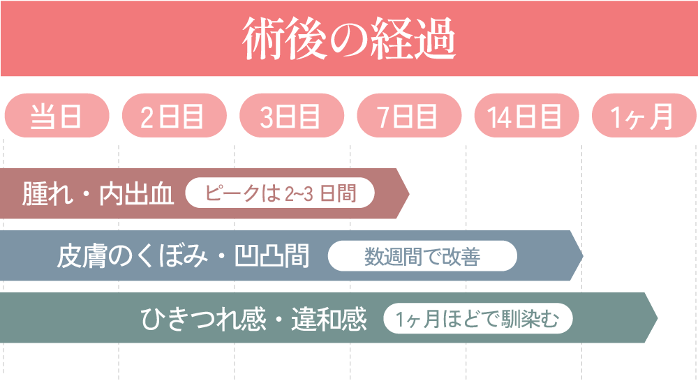 高槻院の糸リフト｜ダウンタイムは？正直にお伝えします<br />
