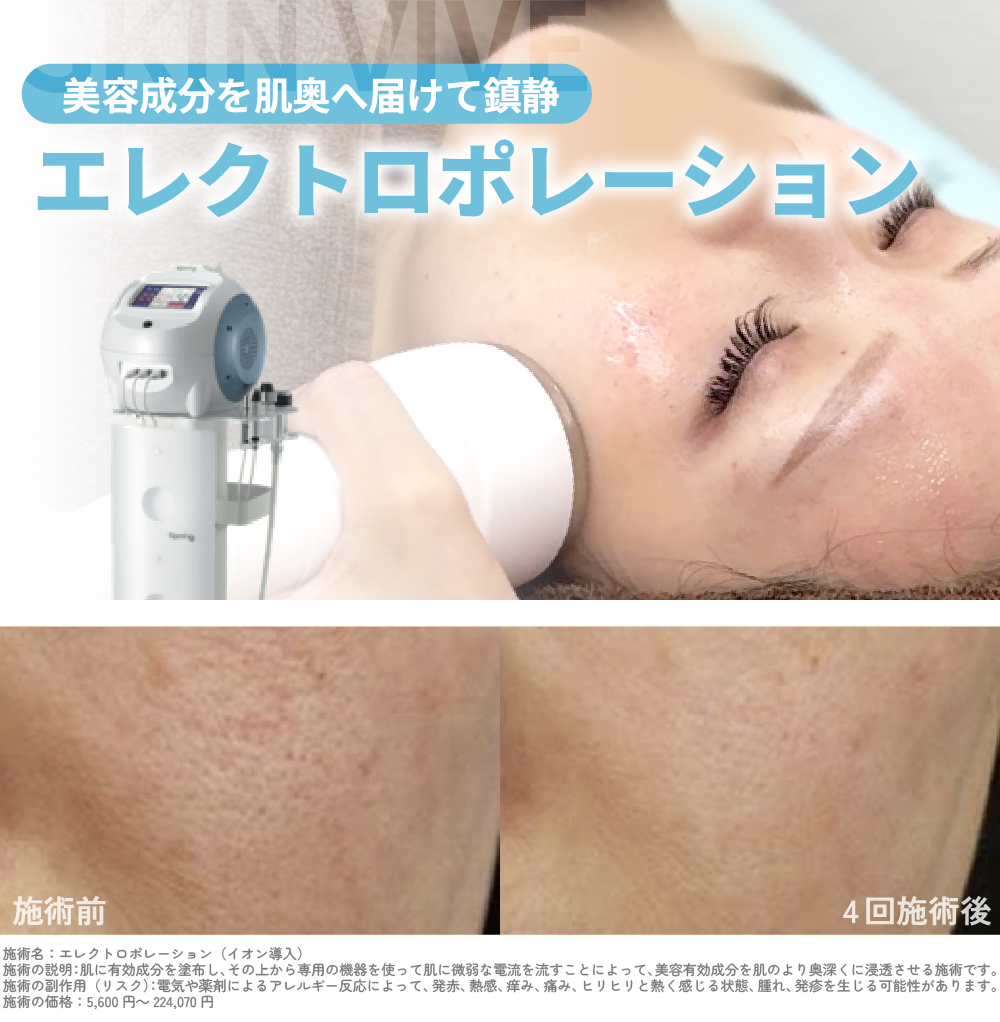 紫外線を浴びてダメージを受けた肌を鎮静