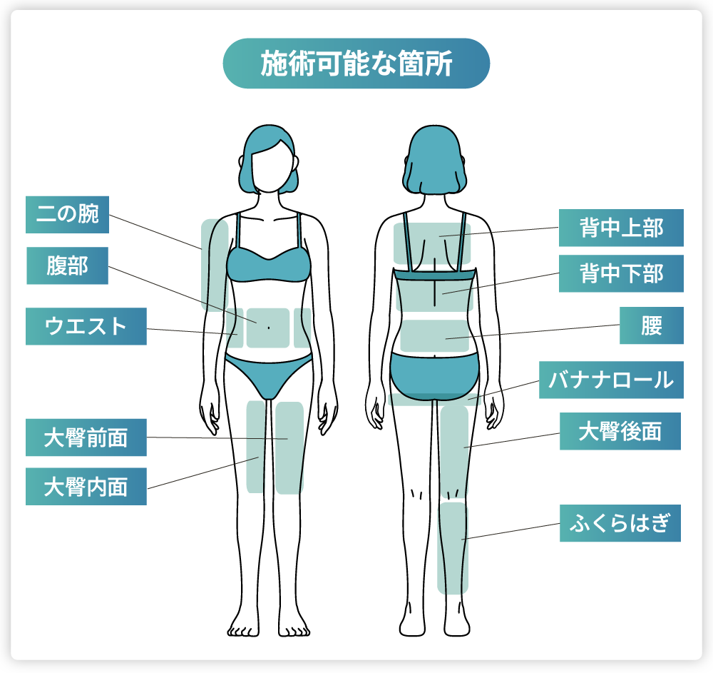 体(ボディ)