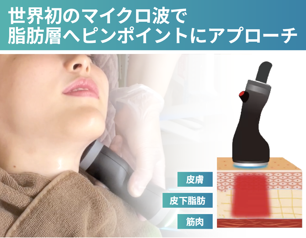 脂肪層へピンポイントアプローチ