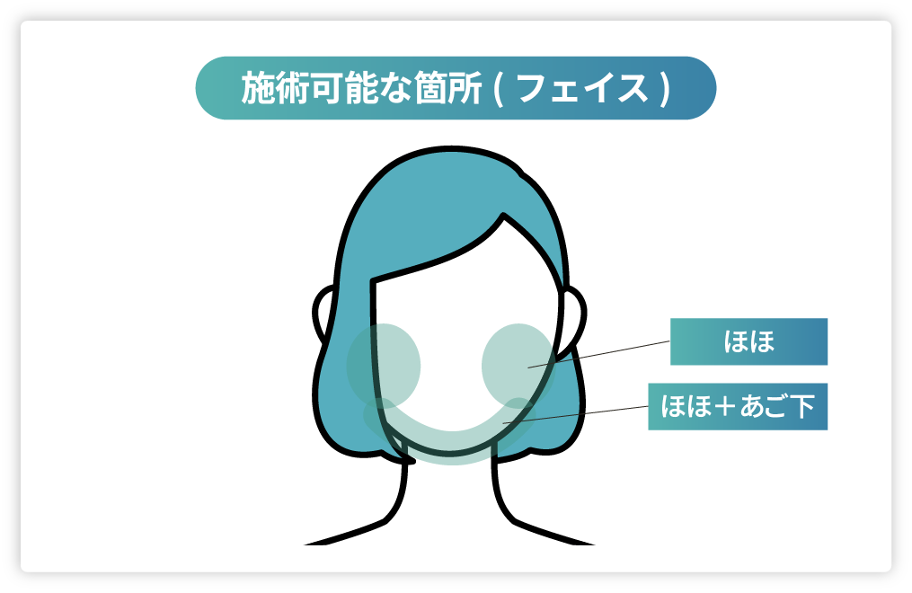 お顔（FACE）の施術可能箇所