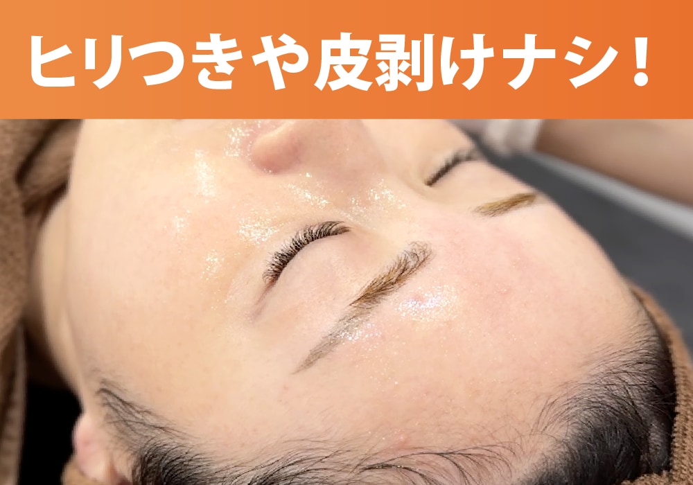 本当にダウンタイムがないの？