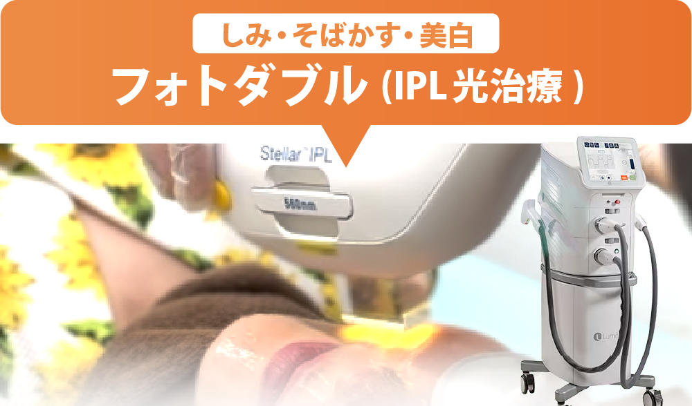 シミ・そばかす・全体のくすみを一掃したい方