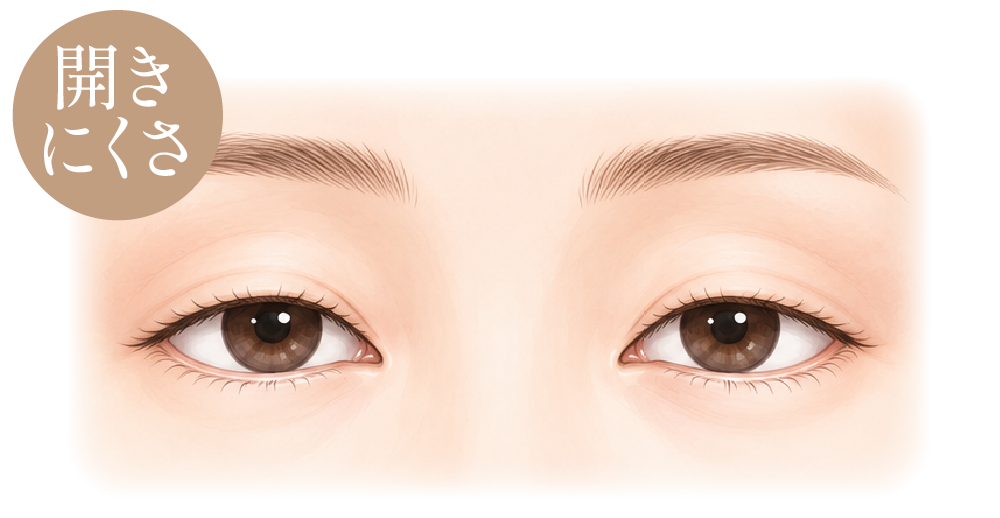 目が開きにくい(眼瞼下垂)
