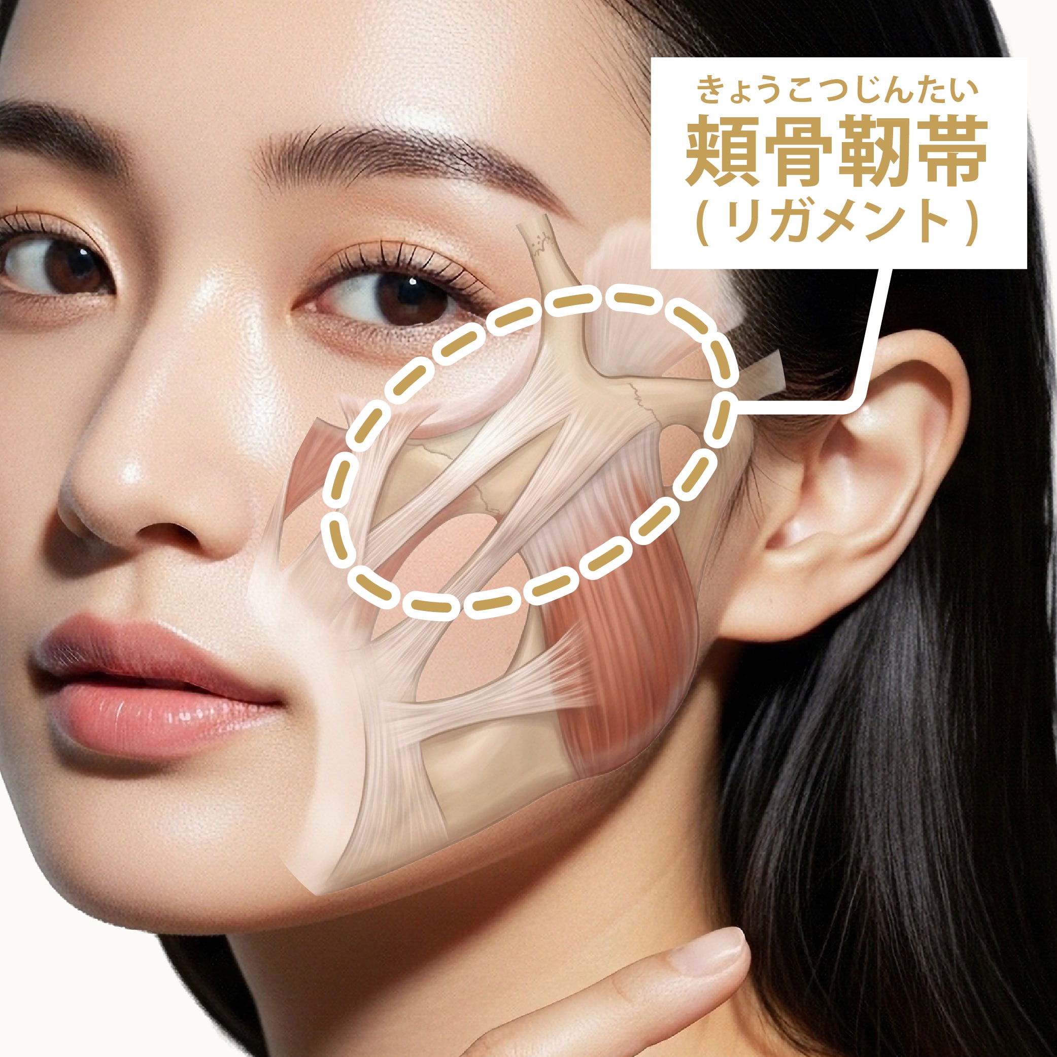 頬骨靭帯アプローチ