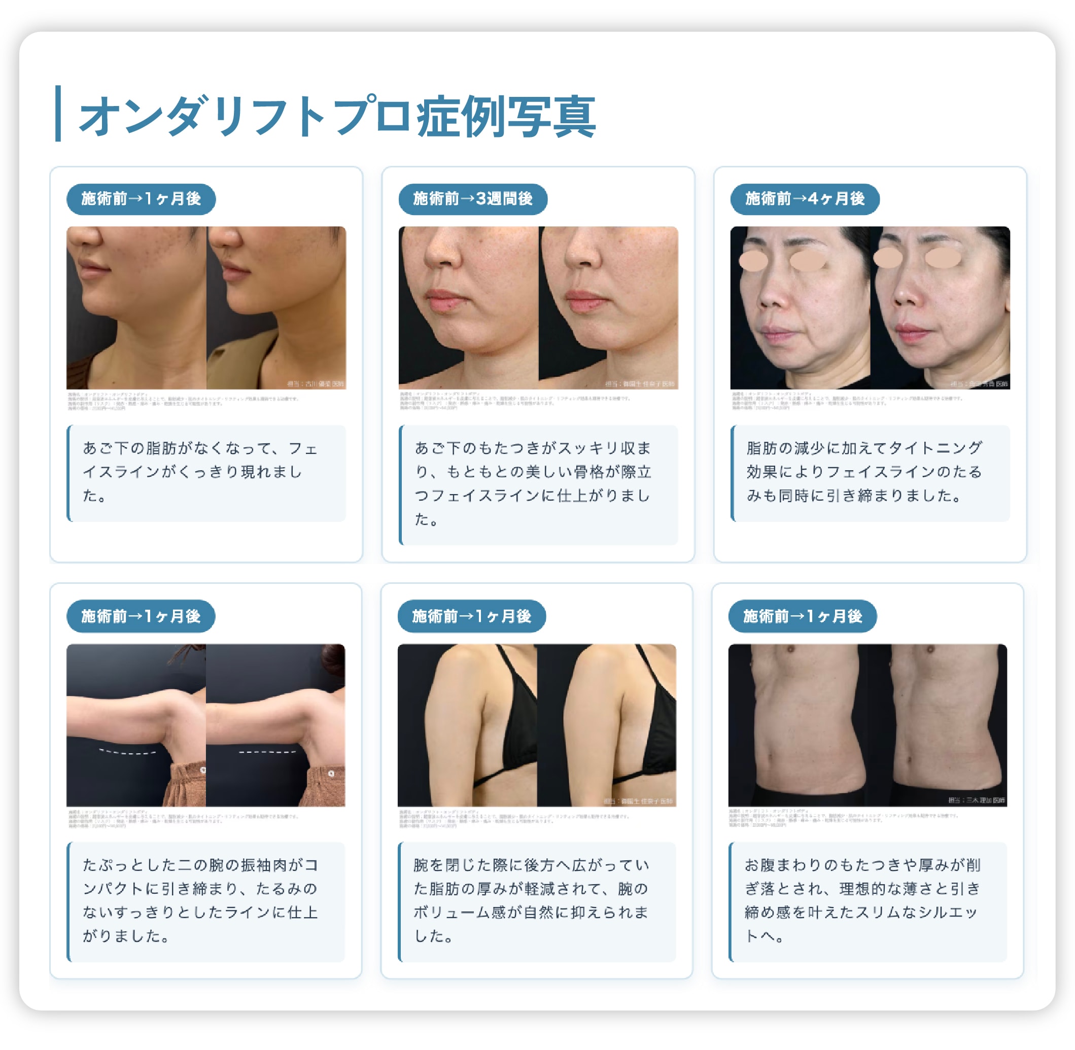 オンダリフトプロ高槻院症例