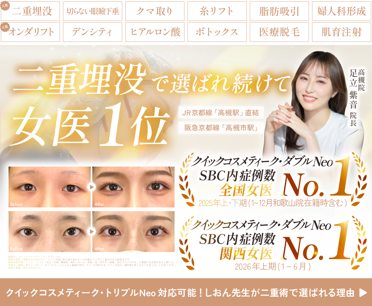 しおん先生の埋没二重術特集を見る