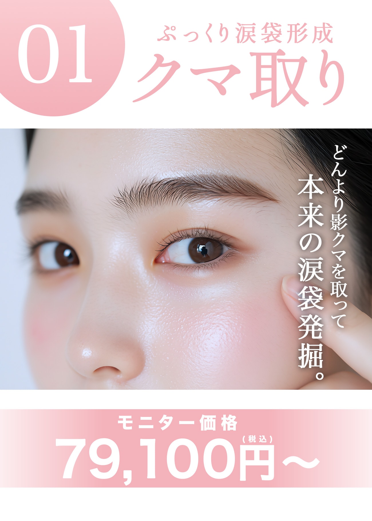 【クマ取り】圧倒的な若返り・印象変化
