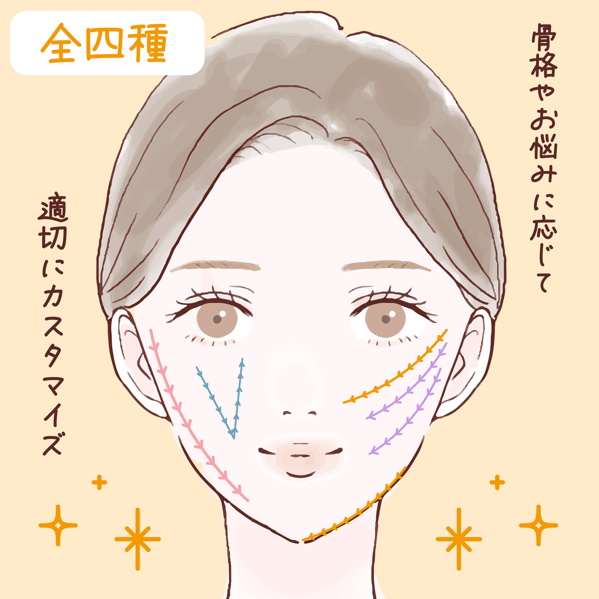 【糸リフト】たるみ・ほうれい線にダイレクトアプローチ！所沢で糸リフトするなら湘南美容クリニック所沢院