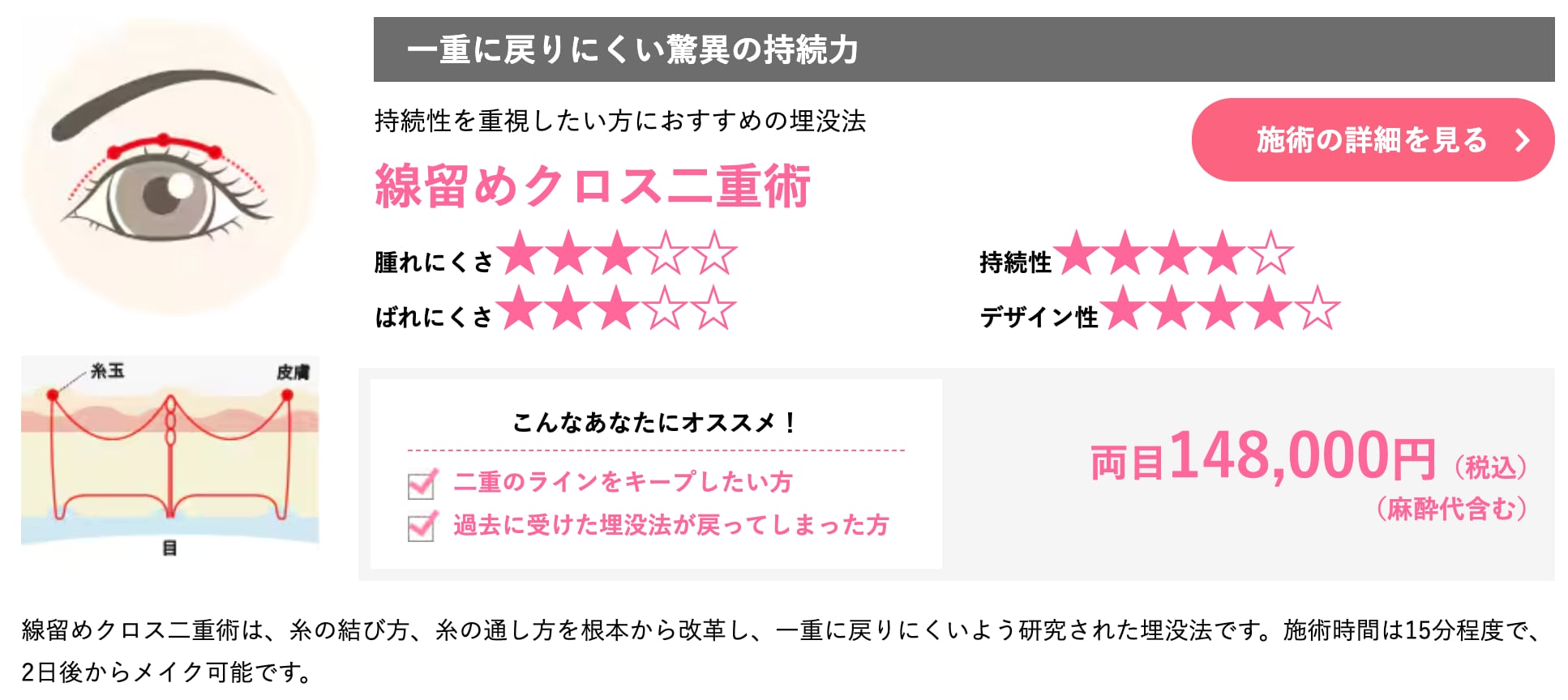 糸の結び方・通し方を根本から改革。驚異の持続力!