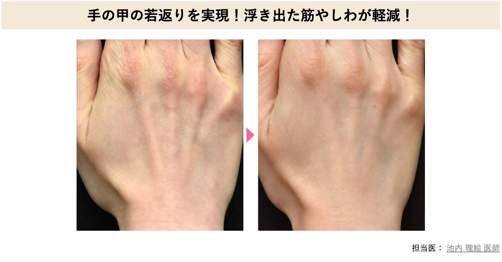 ☑️美容医療が初めてでナチュラル志向の方<br />
☑️自然にバレない範囲で若返りたい方<br />
☑️肌のたるみ・小ジワが気になる方<br />
☑️肌のハリ・うるおいが失われてきたと感じる方<br />
☑️フェイスラインのもたつきが気になる方<br />