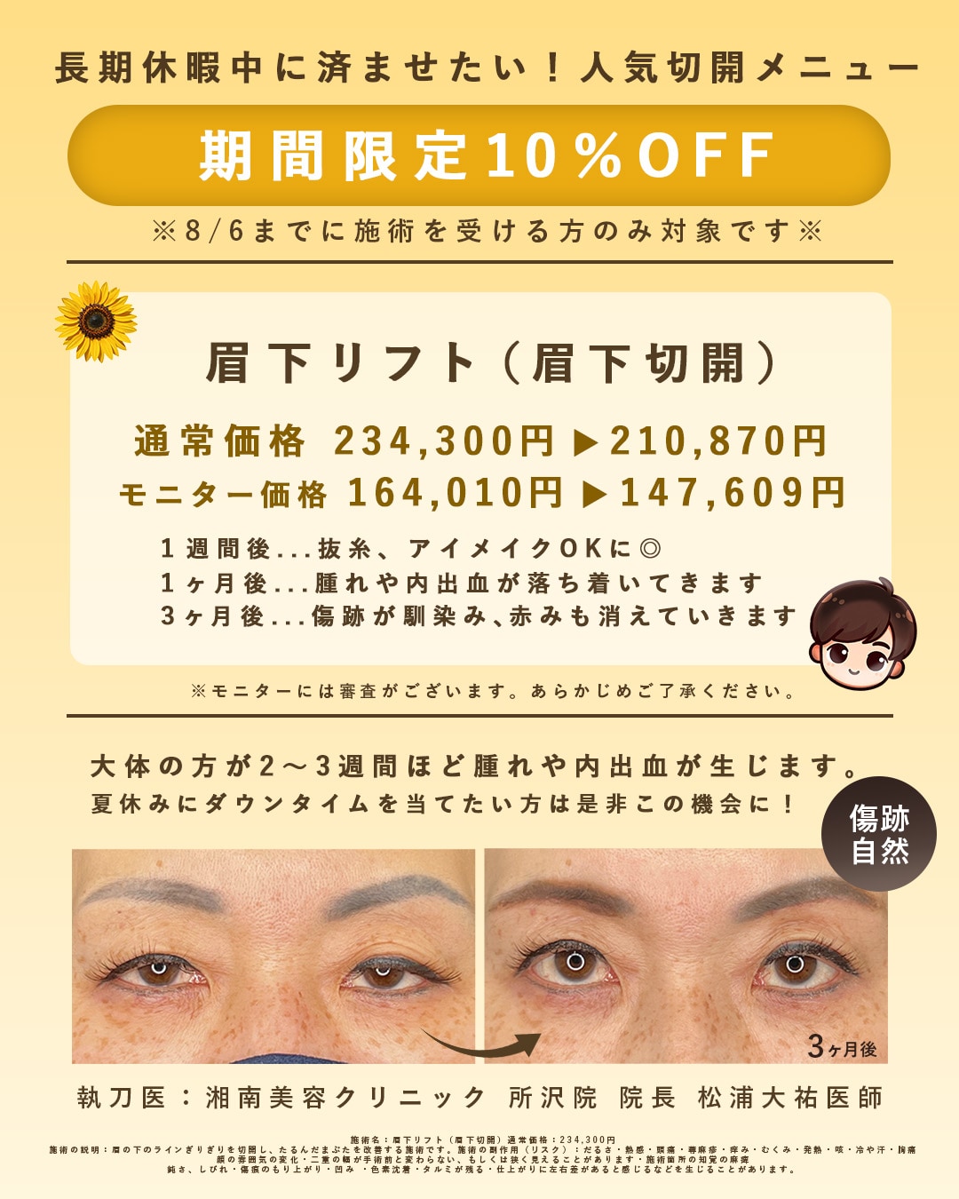 まぶたのたるみをスッキリ切開リフト