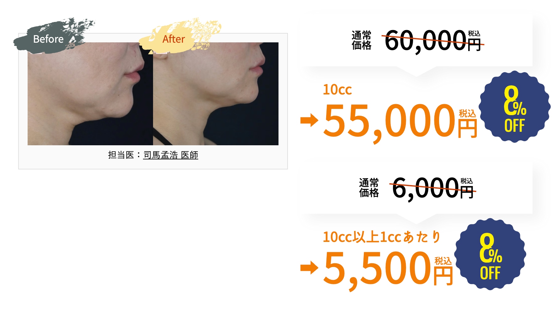 10cc注射が今だけ5,000円OFF✨