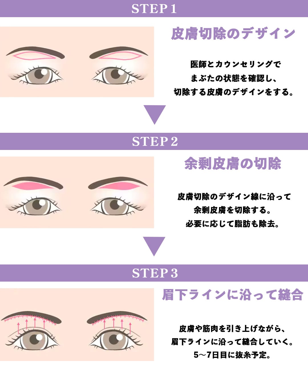 約1時間〜１時間半の施術時間で綺麗に若返ります