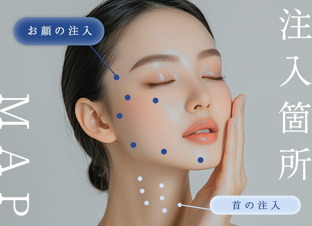 注入箇所MAP