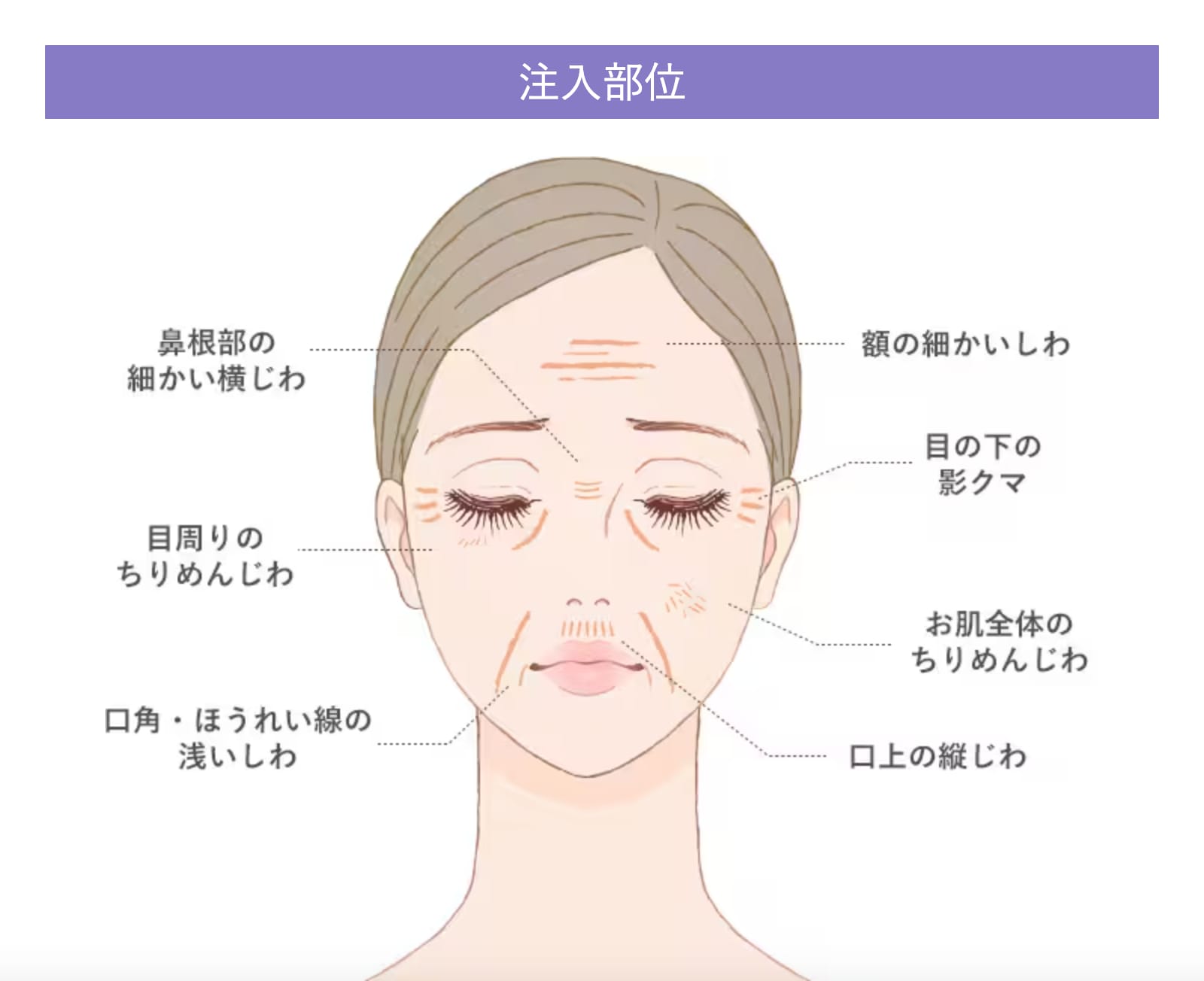 気になる部位にピンポイント注入!