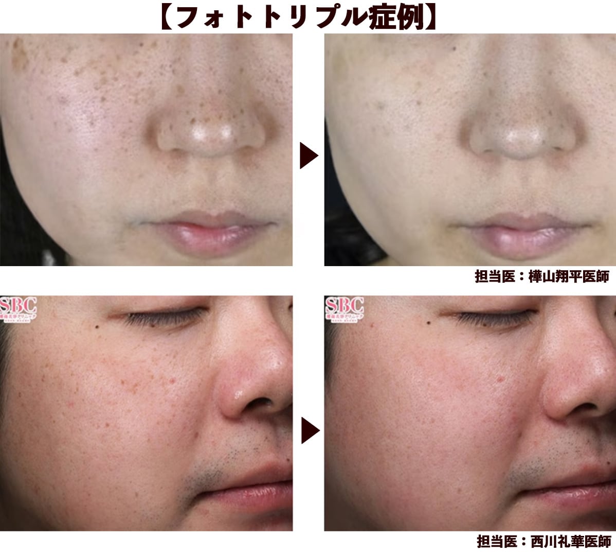 フォトトリプル症例紹介