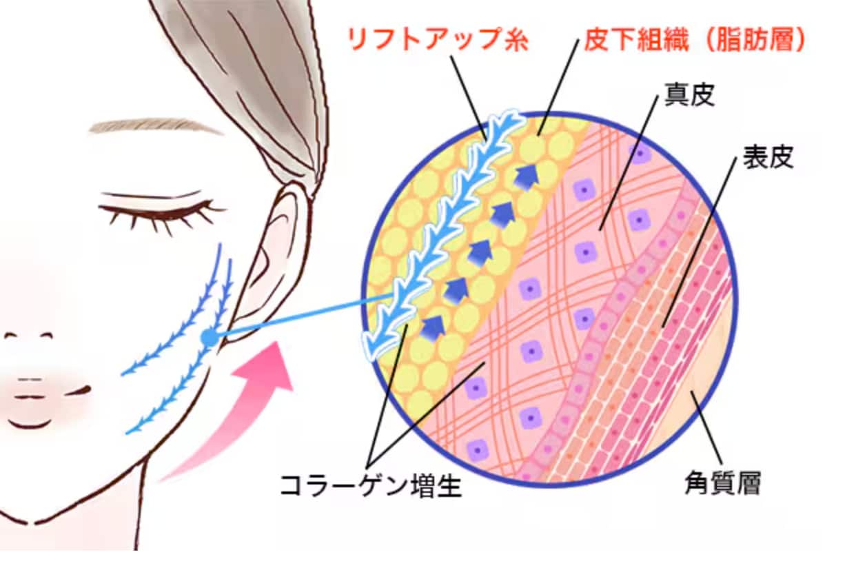 手軽にリフトアップできます✨